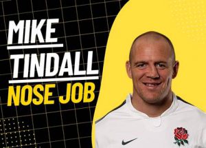 Mike Tindall's Nose Job Photo