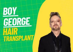 Boy George Hair Transplant photo