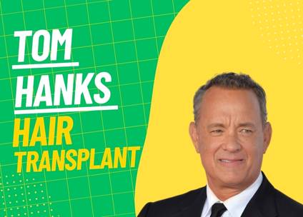 Tom Hanks Hair Transplant: Fact or Fiction?