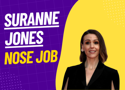 Suranne Jones Nose Job: A Deep Dive