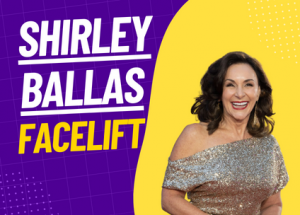 shirley ballas facelift operation