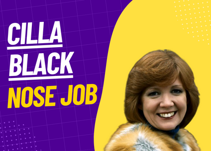 Cilla Black Nose Job: Rumors, Speculations, and the Truth