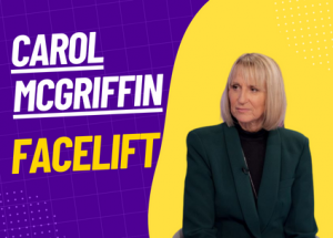 carol mcgriffin facelift operation photo