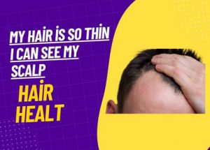 Hair Healt