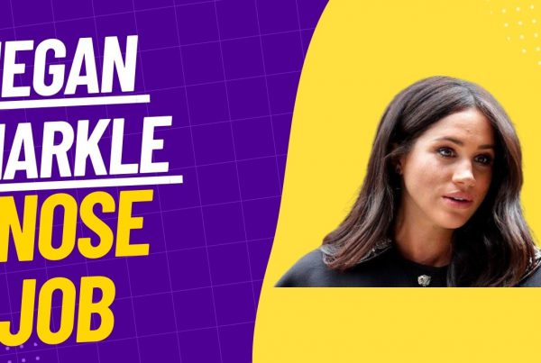 Megan Markle Nose Job Photo