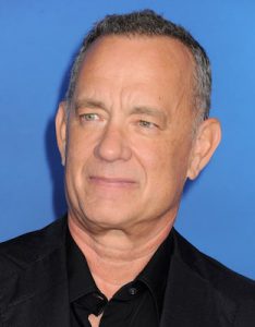 tom hanks hair transplant journey