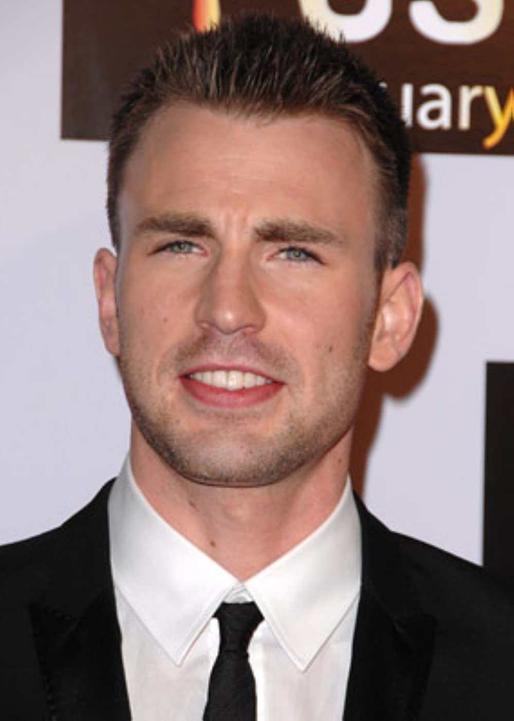 chris evans hair transplant photo