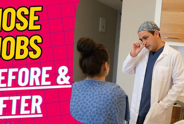 Nose Jobs Before After