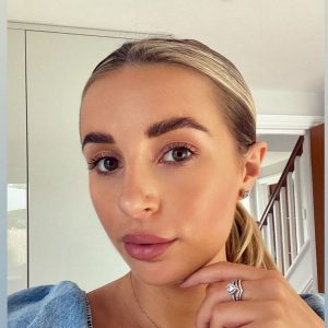 dani dyer nose job
