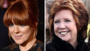 Cilla Black Nose Job Before After