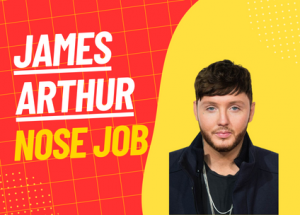 james arthur rhinoplasty