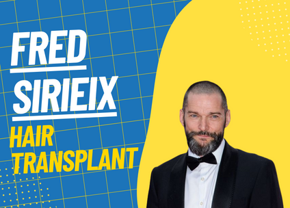 Fred Sirieix Hair Transplant Journey