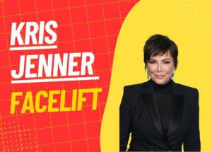 kris jenner facelift Photo