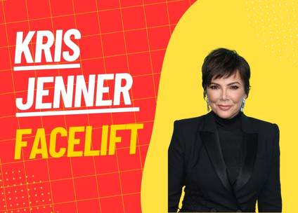 Kris Jenner Facelift