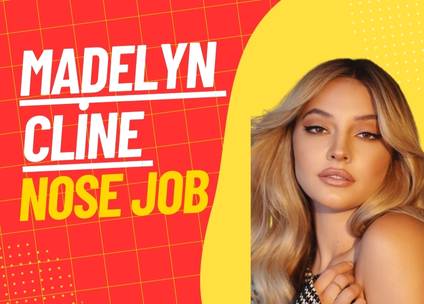 Madelyn Cline Nose Job