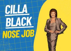 Cilla Black Nose Job Photo