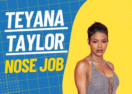 Teyana Taylor Nose Job