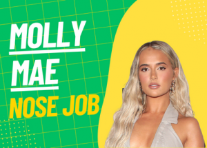 molly mae nose job