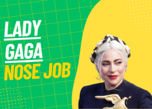 lady gaga nose job