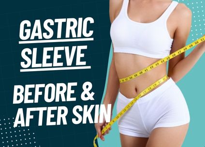 Gastric Sleeve Before and After Skin