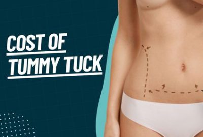 Cost of Tummy Tuck