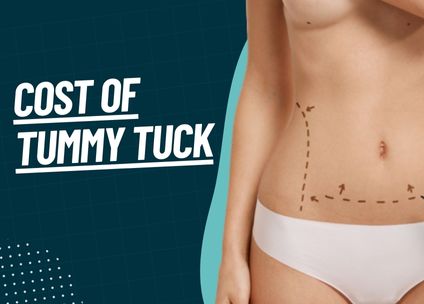 Cost of Tummy Tuck