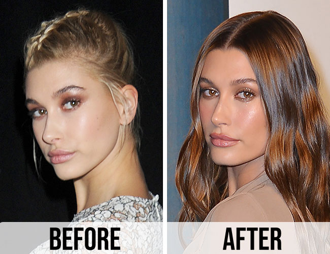 Hailey Bieber Nose Job An In-Depth Look - Cosmeticium