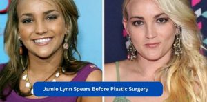 Jamie-Lynn-Spears-Before-Plastic-Surgery-