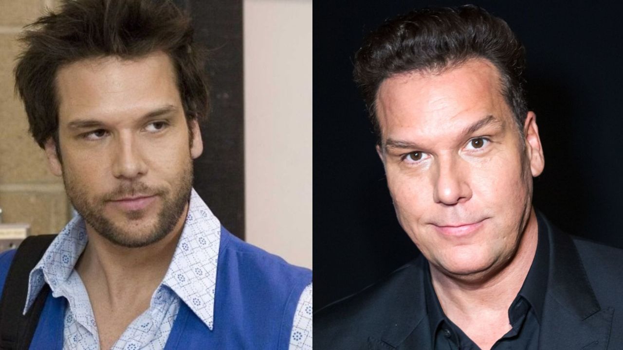 dane cook facelift