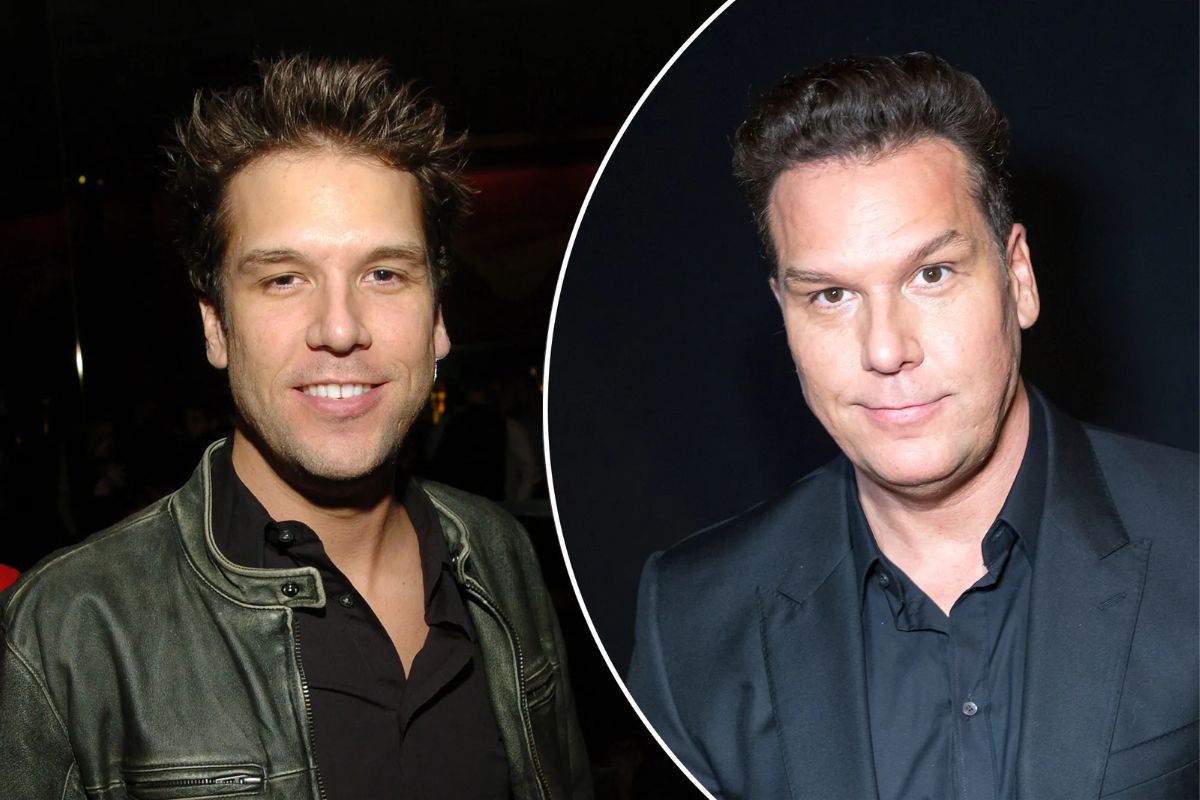 dane cook facelift