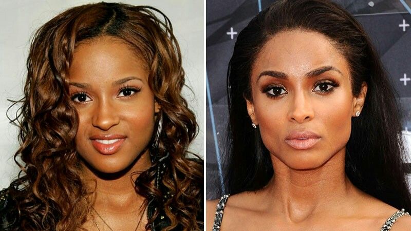 ciara nose job