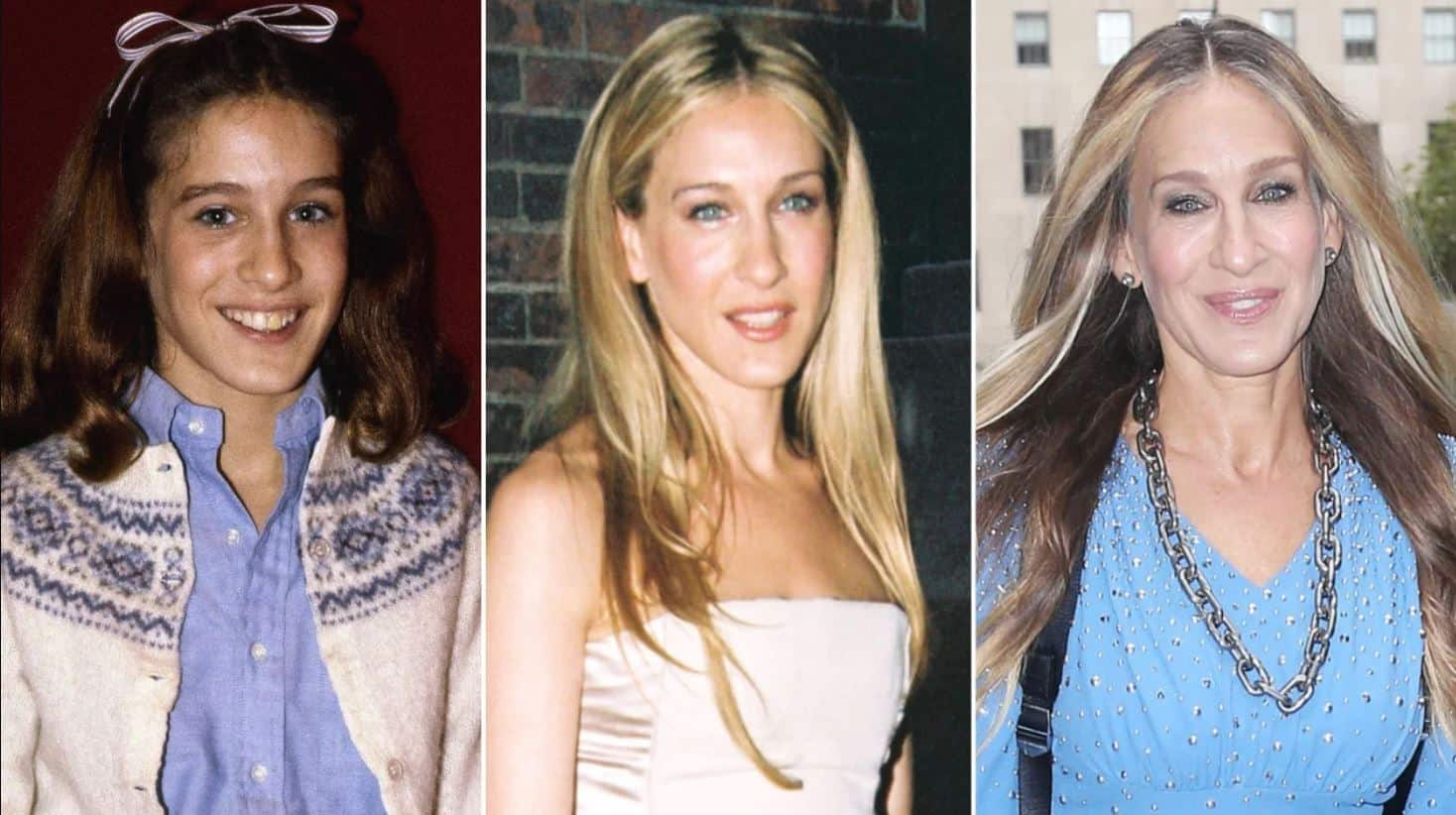 sarah jessica parker nose job