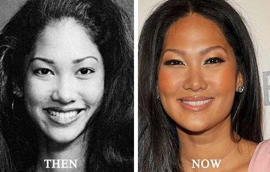  kimora lee simmons nose job