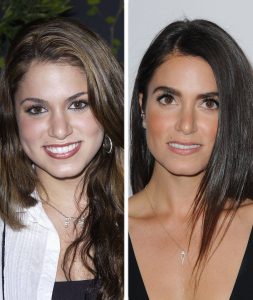 nikki reed nose job