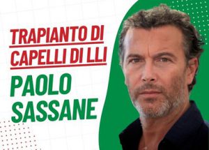 trapianto di capelli di Paolo Sassanelli
