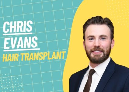 Chris Evans and the Journey of His Hair: A Detailed Analysis