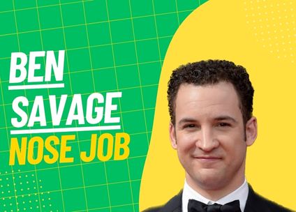 Ben Savage’s Nose Job: A Detailed Analysis