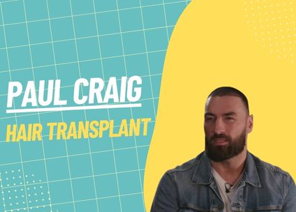 Paul Craig: A Hair Transplant Journey