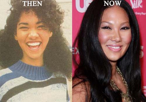 kimora lee simmons nose job