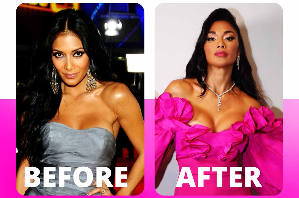 Nicole-Scherzingers-plastic-surgery-