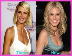 heidi klum before after