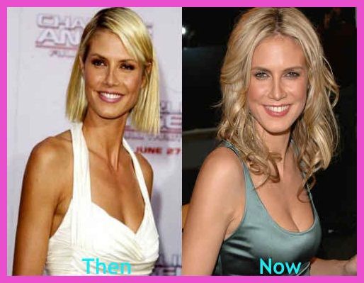 heidi klum before after