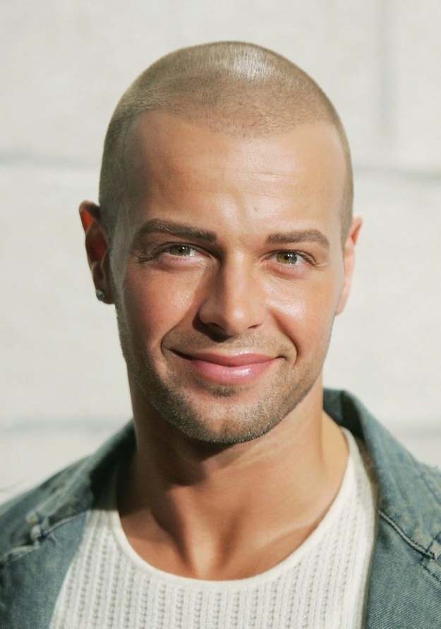 joey lawrence hair transplant