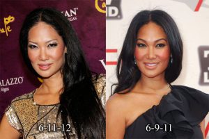 kimora lee simmons nose job
