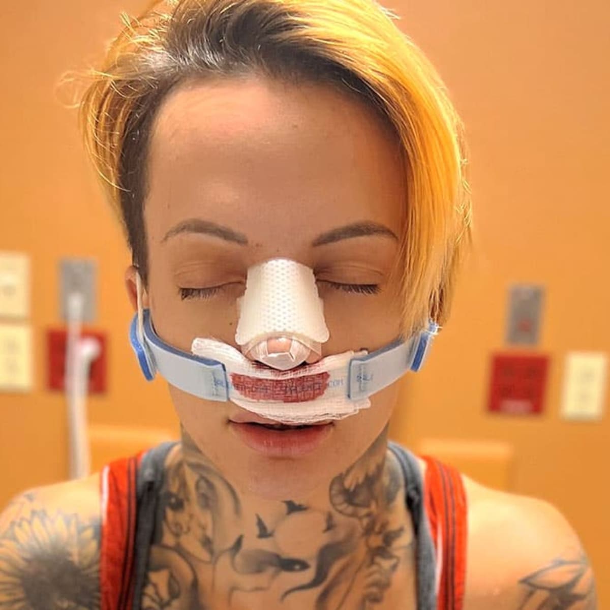 ruby soho nose job