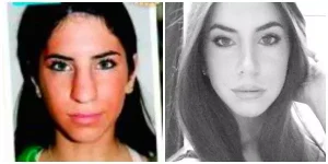 Jen Selter Nose Job surgery