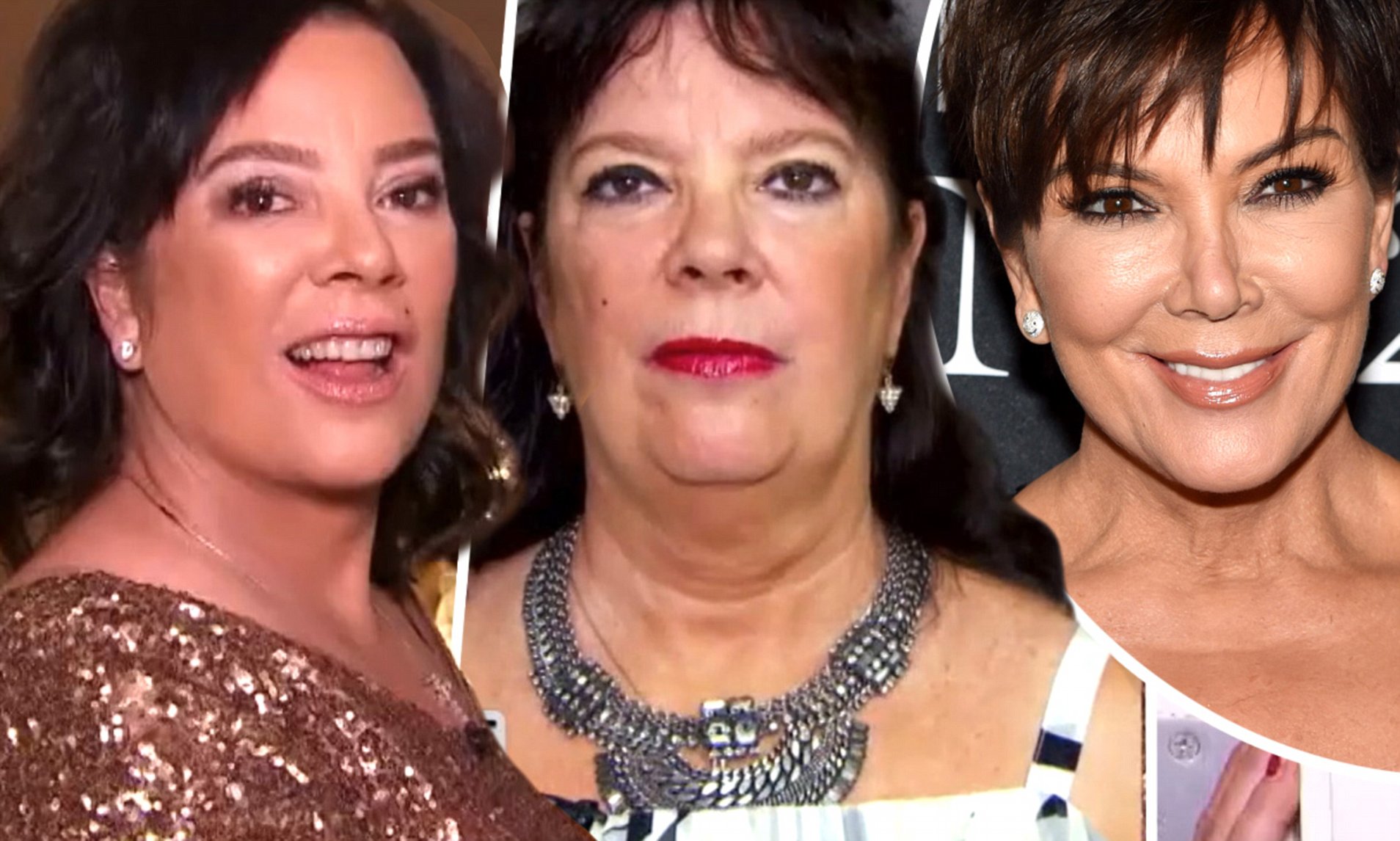 kris jenner sister facelift