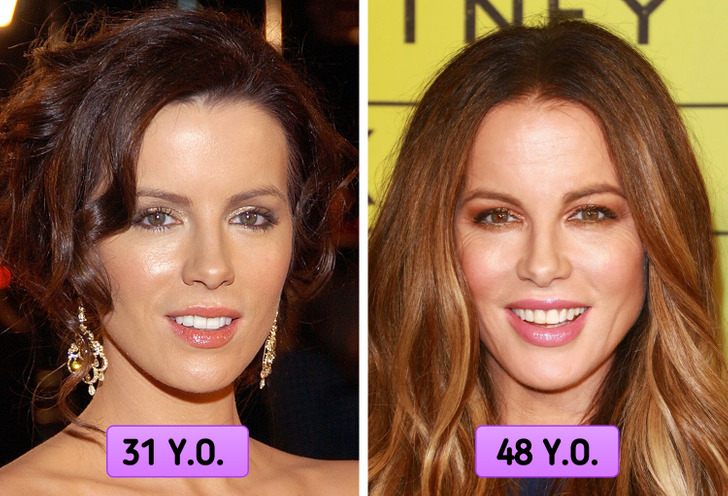 kate beckinsale facelift before after