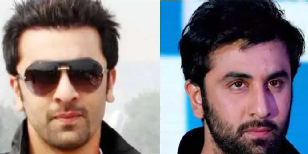 ranbir kapoor hair transplant