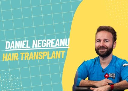 Daniel Negreanu Hair Transplant: An In-depth Analysis